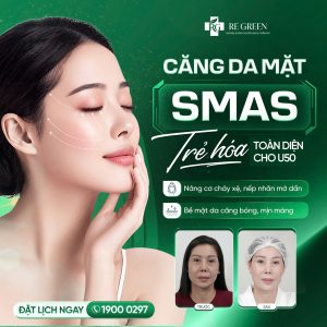 căng da SMAS