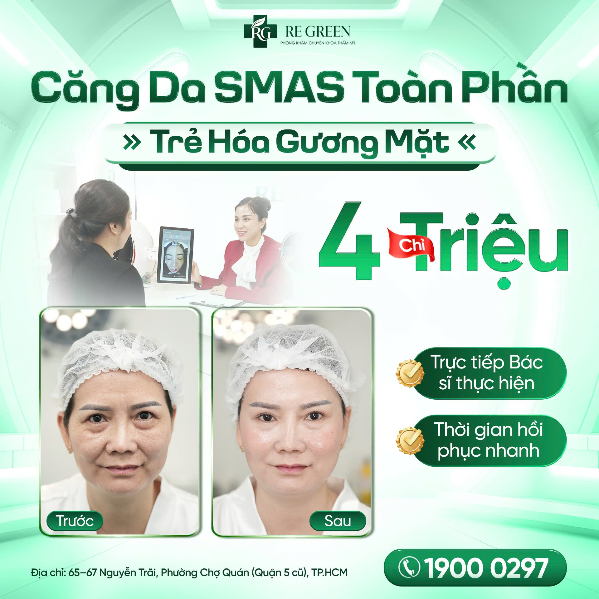 căng da mặt SMAS