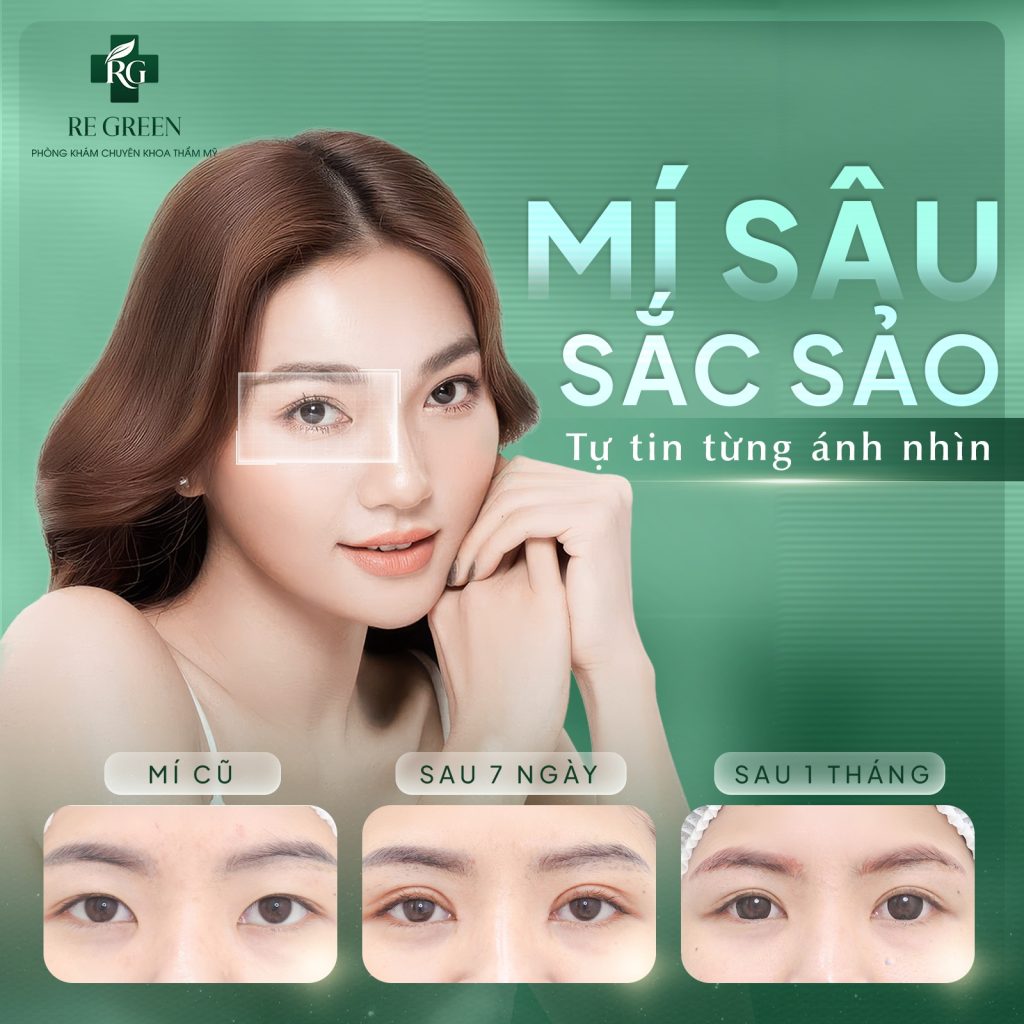 nhấn mí sắc sảo