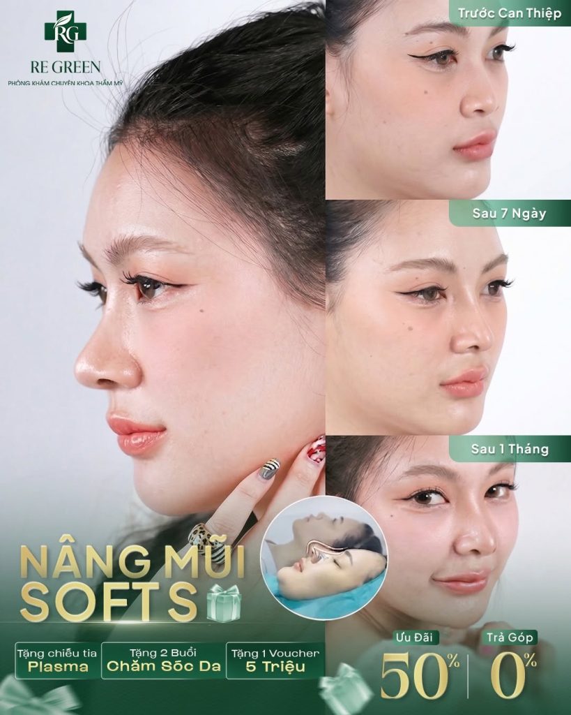 nâng mũi không sẹo