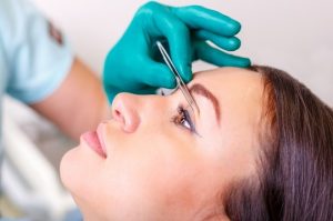 cắt mí mắt một bên