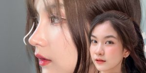 nâng mũi thon gọn