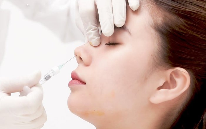 tiêm tan filler